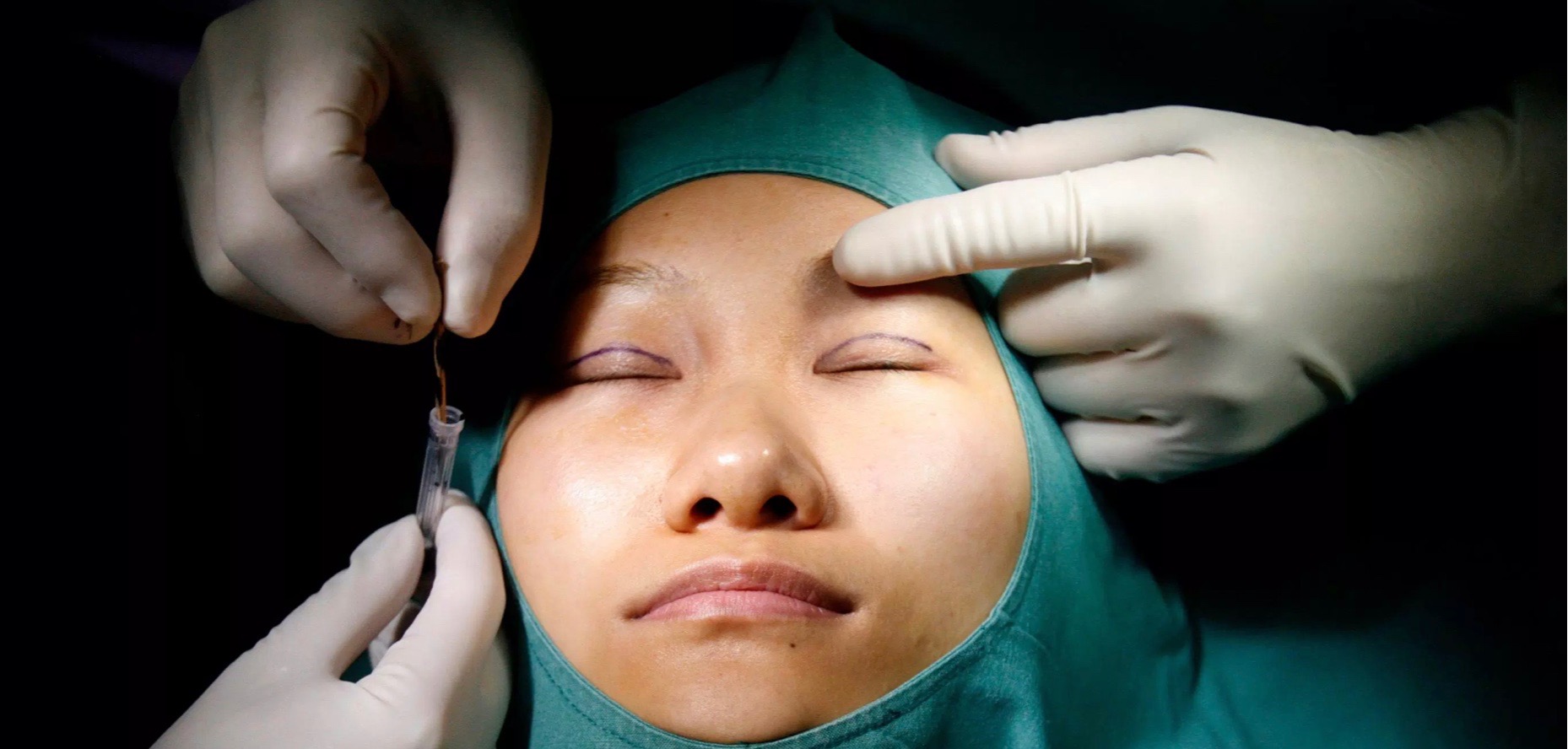 China Plastic Surgery Industry Booms as Millions of Gen Z